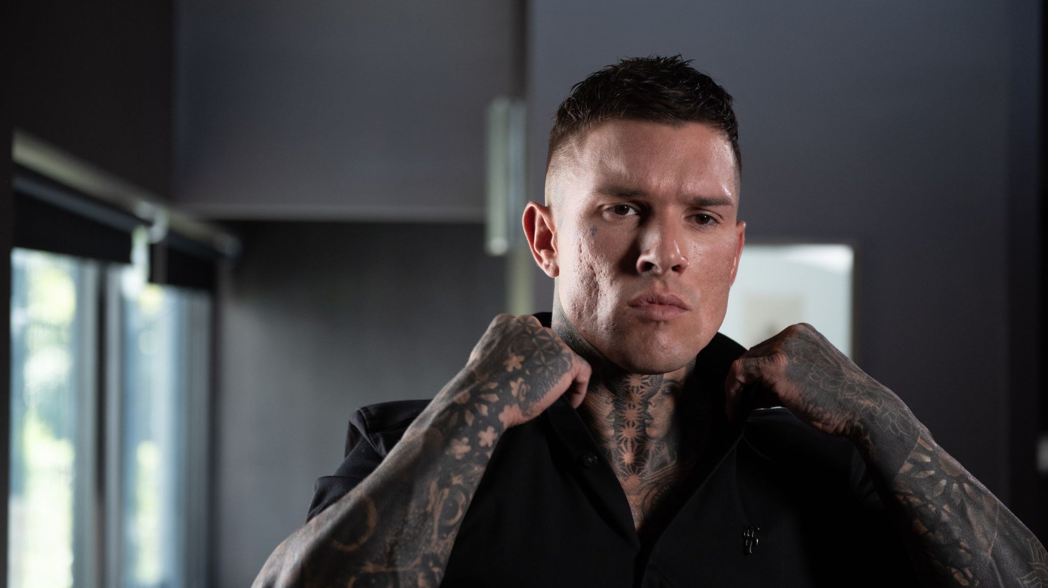 Your Safe Guide to Acne Scar Removal